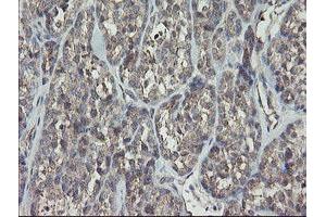 Image no. 3 for anti-Receptor (TNFRSF)-Interacting serine-threonine Kinase 1 (RIPK1) (AA 133-422) antibody (ABIN1490909)