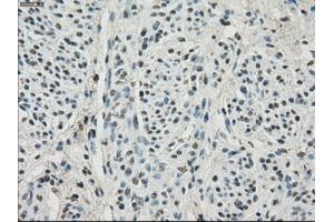 Immunohistochemical staining of paraffin-embedded Ovary tissue using anti-HDAC10mouse monoclonal antibody. (HDAC10 抗体)