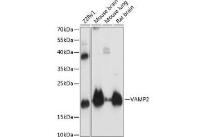 Western blot analysis of extracts of various cell lines, using V antibody (ABIN3021846, ABIN3021847, ABIN1513674 and ABIN6216136) at 1:3000 dilution. (VAMP2 抗体  (AA 1-100))