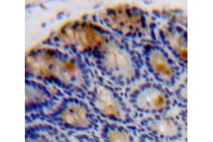 Used in DAB staining on fromalin fixed paraffin-embedded Intestine tissue (IL-37 抗体  (AA 46-218))