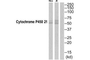 Western Blotting (WB) image for anti-Cytochrome P450, Family 21, Subfamily A, Polypeptide 2 (CYP21A2) (C-Term) antibody (ABIN1852650) (CYP21A2 抗体  (C-Term))