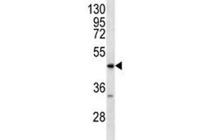 RAGE antibody western blot analysis in MDA-MB231 lysate. (RAGE 抗体  (AA 348-378))