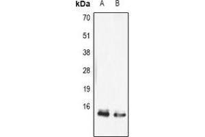 Western blot analysis of FABP5 expression in mouse skin (A), mouse thymus (B) whole cell lysates. (FABP5 抗体)