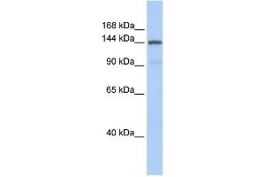 WB Suggested Anti-COL1A2 Antibody Titration: 0. (COL1A2 抗体  (Middle Region))