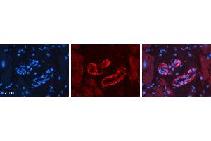 Rabbit Anti-SPRY2 Antibody   Formalin Fixed Paraffin Embedded Tissue: Human heart Tissue Observed Staining: Cytoplasmic in vasculature Primary Antibody Concentration: 1:100 Other Working Concentrations: 1:600 Secondary Antibody: Donkey anti-Rabbit-Cy3 Secondary Antibody Concentration: 1:200 Magnification: 20X Exposure Time: 0. (SPRY2 抗体  (N-Term))