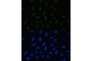 Immunofluorescence analysis of U-2 OS cells using PELP1 Polyclonal Antibody (ABIN3023501, ABIN3023502, ABIN3023503 and ABIN6220149) at dilution of 1:100 (40x lens).