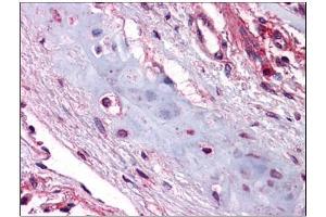 Human Lung, Chondrocytes: Formalin-Fixed, Paraffin-Embedded (FFPE) (UCMA 抗体  (C-Term))