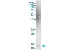 HBXIP monoclonal antibody (M12), clone 4G1.