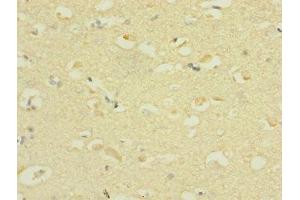 Immunohistochemistry of paraffin-embedded human brain tissue using ABIN7169924 at dilution of 1:100 (SCN3A 抗体  (AA 274-400))