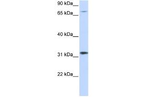 WB Suggested Anti-ZNF799 Antibody Titration:  0. (ZNF799 抗体  (Middle Region))