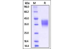 SDS-PAGE (SDS) image for Fc Fragment of IgG, Low Affinity IIb, Receptor (CD32) (FCGR2B) (AA 40-217) (Active) protein (His tag) (ABIN2870737)
