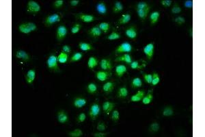 Immunofluorescence staining of Hela cells with ABIN7156000 at 1:166, counter-stained with DAPI. (HMGCS1 抗体  (AA 360-520))