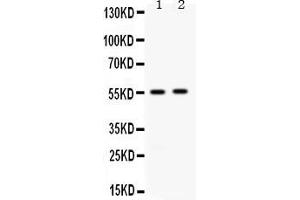 Western blot analysis of ALDH3A2 expression in rat liver extract ( Lane 1) and 22RV1 whole cell lysates ( Lane 2). (ALDH3A2 抗体  (AA 1-100))