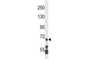 MLL5 antibody western blot analysis in HL-60 lysate. (MLL5/KMT2E 抗体  (AA 93-120))