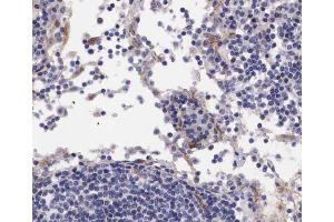 ABIN6267676 at 1/100 staining human lymph node tissue sections by IHC-P. (B-Cell Linker 抗体  (pTyr96))
