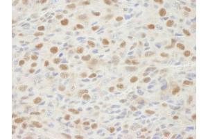 Immunohistochemistry (IHC) image for anti-Mismatch Repair Protein 2 (MSH2) (C-Term) antibody (ABIN7448673) (MSH2 抗体  (C-Term))