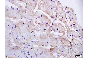 Formalin-fixed and paraffin embedded mouse heart labeled with Anti-PAP2B Polyclonal Antibody, Unconjugated (ABIN754228) at 1:200 followed by conjugation to the secondary antibody and DAB staining (PPAP2B 抗体  (AA 241-311))