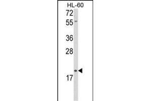 Western blot analysis of DLK2 Antibody (C-term) (ABIN652972 and ABIN2842616) in HL-60 cell line lysates (35 μg/lane). (DLK2 抗体  (C-Term))