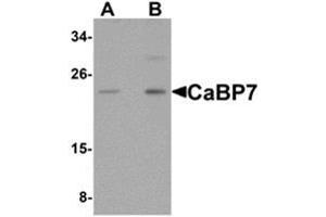 Western blot analysis of CaBP7 in Hela cell lysate with CaBP7 antibody at (A) 1 and (B) 2 μg/ml. (CABP7 抗体  (N-Term))