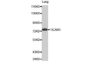 Western Blotting (WB) image for anti-Toll-Like Receptor Adaptor Molecule 1 (TICAM1) (AA 20-200) antibody (ABIN6215259) (TICAM1 抗体  (AA 20-200))