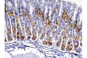 IHC analysis of Periostin using anti-Periostin antibody . (Periostin 抗体  (AA 577-810))