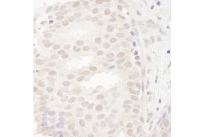 Immunohistochemistry (IHC) image for anti-Cancer Susceptibility Candidate 5 (CASC5) (AA 300-350) antibody (ABIN7448458) (CASC5 抗体  (AA 300-350))