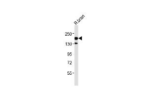Anti-ERBB4 Antibody (C-term) at 1:500 dilution + rat brain lysates Lysates/proteins at 20 μg per lane.