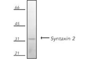 Western blot analysis of human Jurkat cell lysate, probed with Syntaxin 2 pAb. (STX2 抗体  (N-Term))