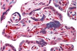 Human Placenta (formalin-fixed, paraffin-embedded) stained with ORAI2 antibody ABIN214005 at 5 ug/ml followed by biotinylated goat anti-rabbit IgG secondary antibody ABIN481713, alkaline phosphatase-streptavidin and chromogen. (ORAI2 抗体  (C-Term))
