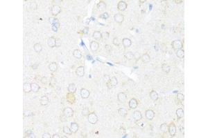 Immunohistochemistry of paraffin-embedded Rat brain using EIF3J Polyclonal Antibody at dilution of 1:100 (40x lens). (EIF3S1 抗体)