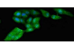 Immunofluorescent analysis of HepG2 cells using ABIN7142559 at dilution of 1:100 and Alexa Fluor 488-congugated AffiniPure Goat Anti-Rabbit IgG(H+L)