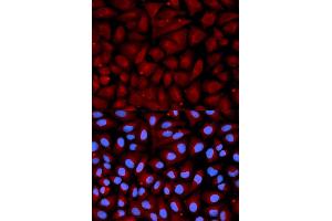 Immunofluorescence analysis of U2OS cells using SERPINC1 antibody. (SERPINC1 抗体)