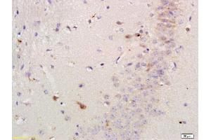 Immunohistochemistry (Paraffin-embedded Sections) (IHC (p)) image for anti-Versican (Vcan) (AA 3301-3396) antibody (ABIN741660)
