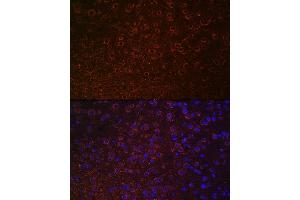 Immunofluorescence (IF) image for anti-Solute Carrier Family 6 (Neurotransmitter Transporter, Dopamine), Member 3 (SLC6A3) (C-Term) antibody (ABIN7270474)