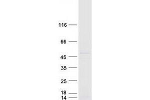 Validation with Western Blot