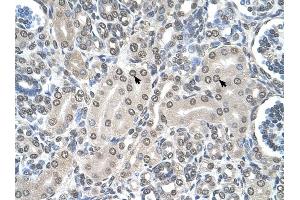 SHMT2 antibody was used for immunohistochemistry at a concentration of 4-8 ug/ml to stain Epithelial cells of renal tubule (arrows) in Human Kidney. (SHMT2 抗体)