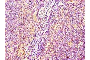 Immunohistochemistry of paraffin-embedded human lymph node tissue using ABIN7175013 at dilution of 1:100 (C17orf58 抗体  (AA 21-90))