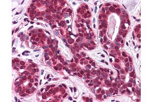 Anti-SLC5A6 antibody IHC of human breast.