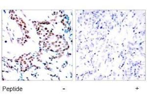 Image no. 1 for anti-Jun Proto-Oncogene (JUN) (Tyr170) antibody (ABIN197132) (C-JUN 抗体  (Tyr170))