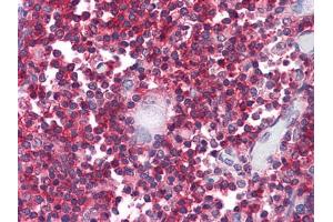 Immunohistochemical analysis of paraffin-embedded human Thymus tissues using anti-CD247 mouse mAb (CD247 抗体)