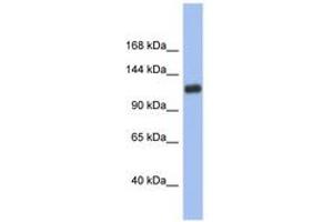 Image no. 1 for anti-Hypoxia Inducible Factor 1, alpha Subunit (Basic Helix-Loop-Helix Transcription Factor) (HIF1A) (AA 755-804) antibody (ABIN6742743)