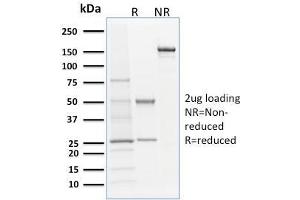 SDS-PAGE Analysis Purified Langerin Mouse Monoclonal Antibody (LGRN/1821). (CD207 抗体  (AA 74-213))