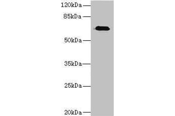 Calpain 6 Antikörper  (AA 195-494)