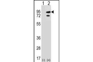 Western blot analysis of SNRK (arrow) using rabbit polyclonal SNRK Antibody (Center) (ABIN652303 and ABIN2841382). (SNRK 抗体  (AA 320-349))