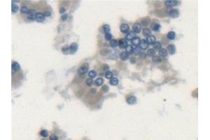 Detection of LSP1 in Rat Small intestine Tissue using Polyclonal Antibody to Lymphocyte Specific Protein 1 (LSP1) (LSP1 抗体  (AA 127-331))