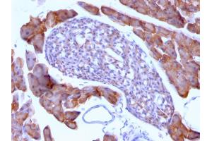 Immunohistochemistry (IHC) image for anti-Ornithine Decarboxylase 1 (ODC1) antibody (ABIN6940235)