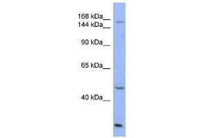 WB Suggested Anti-ATP7A Antibody Titration:  0. (ATP7A 抗体  (Middle Region))
