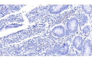 Detection of S100A12 in Bovine Small intestine Tissue using Polyclonal Antibody to S100 Calcium Binding Protein A12 (S100A12) (S100A12 抗体  (AA 2-92))