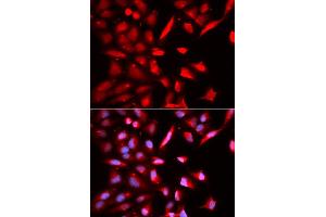 Immunofluorescence (IF) image for anti-Proteasome (Prosome, Macropain) 26S Subunit, ATPase, 3 (PSMC3) antibody (ABIN1874383) (PSMC3 抗体)