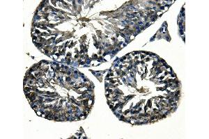 IHC analysis of Adam28 using anti-Adam28 antibody (ABIN7600945).